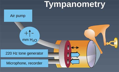Tympanometry test, tympanometry types & abnormal .
